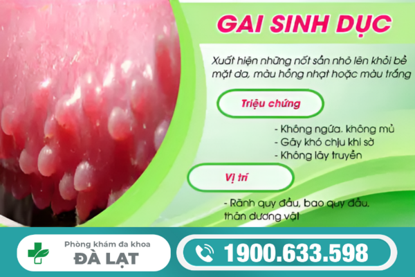 Hình ảnh minh họa